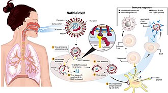 Coronavirus disease 2019
