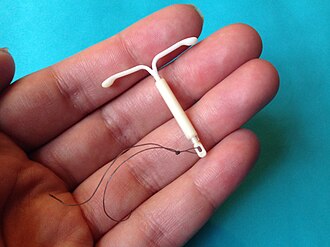 Intrauterine device